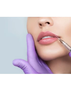 Lip Augmentation