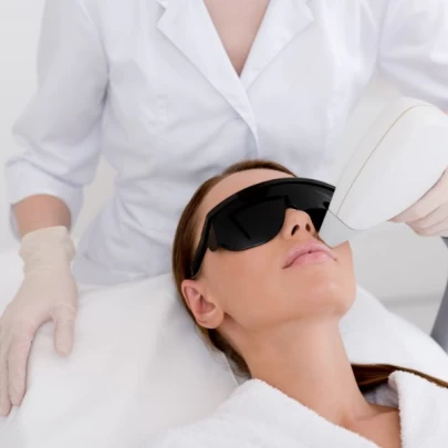 Laser Facial Hair Removal